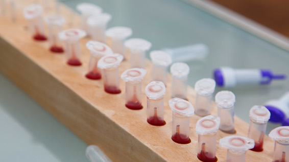 Bei der Blutabnahme für den Laktattest kommen Kapillarröhrchen zum Einsatz, um sicherzustellen, dass immer diesselbe Menge Blut entnommen wird. / Bild: Thomas Polzer