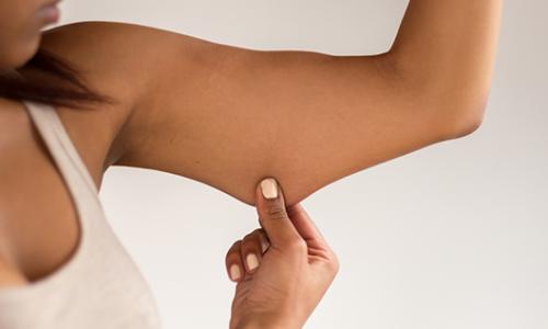 Schlaffe Haut nach dem Abnehmen? Das kannst du dagegen tun … / Bild: iStock / mheim3011 Thumbnail