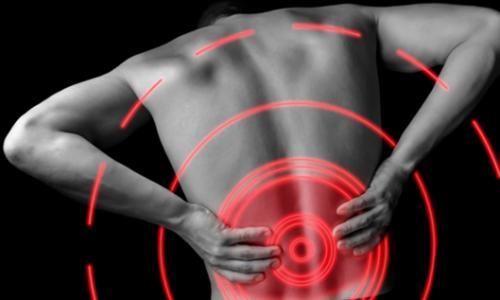 Rückenschmerzen: Das harmlose Volksleiden / Bild: iStock Thumbnail