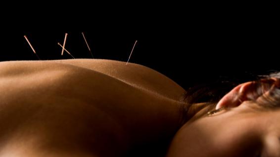 4 alternative Therapiemethoden gegen Schmerzen: Akupunktur / Bild: YanC