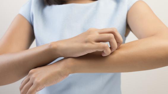 Gelsen-Alarm: Wen juckt's? / Bild: iStock / Tharakorn Gelsen-Alarm: Wen juckt's? / Bild: iStock / Tharakorn
