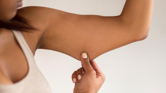5 Tipps, um überschüssige Haut zu entfernen / Bild: iStock / Ridofranz